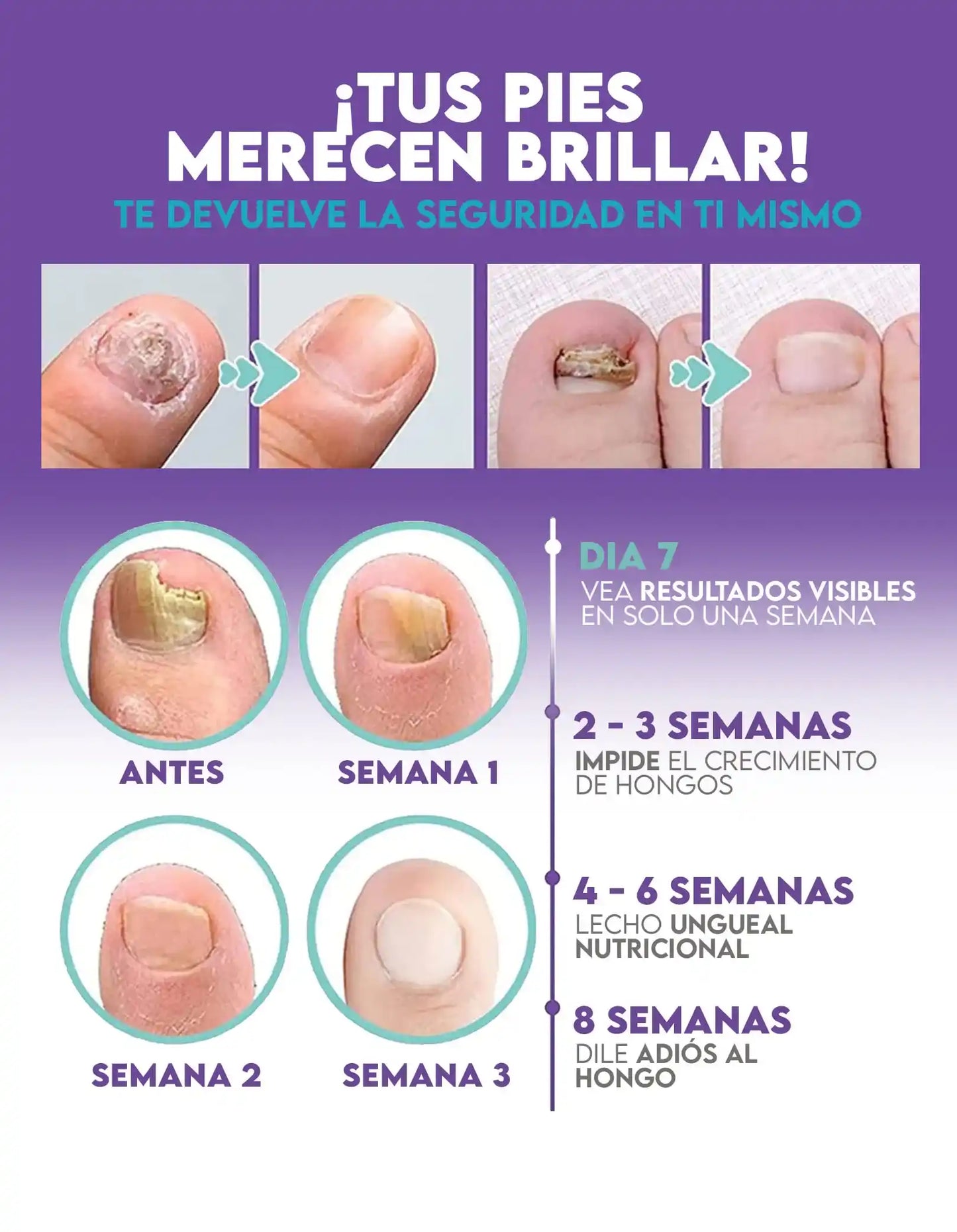 ¡Super Oferta!  Medinail Spray – ¿Listo para volver a lucir uñas limpias y saludables?